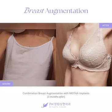 Slider image (4) JW Plastic Surgery Korea